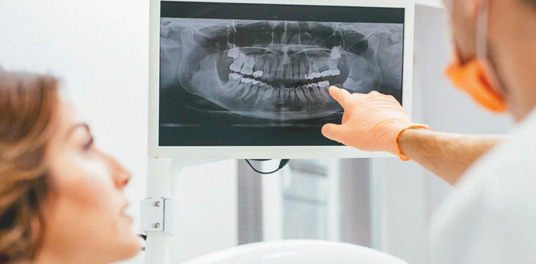 The Role of Imaging Techniques in Evaluating TMJ Disorders